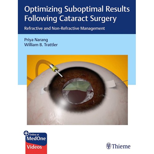 Optimizing Suboptimal Results Following Cataract Surgery 1st Ed.