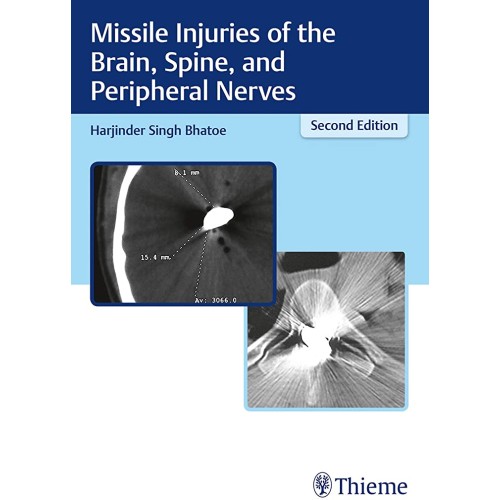 Missile Injuries of the Brain, Spine, and Peripheral Nerves 2nd Ed.