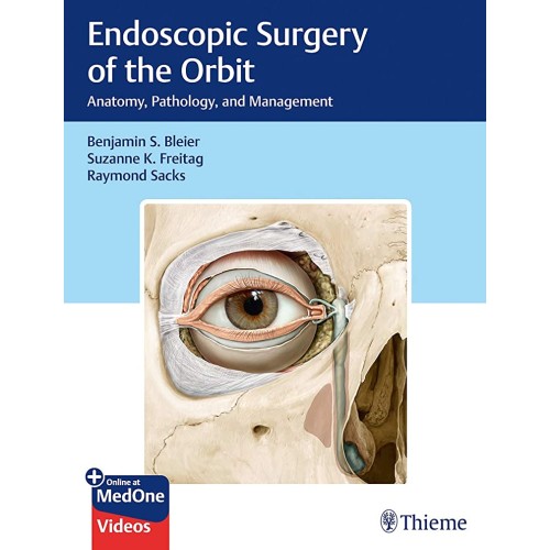 Endoscopic Surgery of the Orbit 1st Ed.