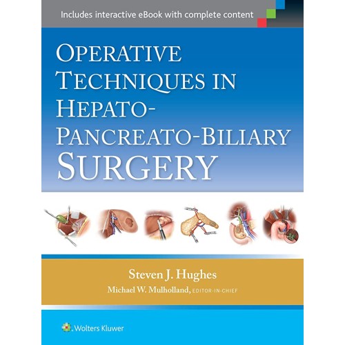 Operative Techniques in Hepato-Pancreato-Bili...