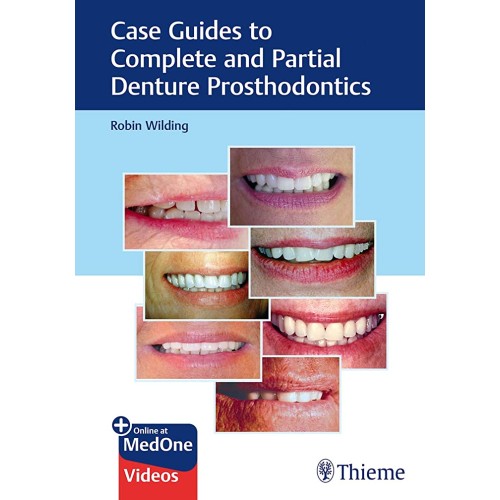 Case Guides to Complete and Partial Denture Prosthodontics 1st Ed.