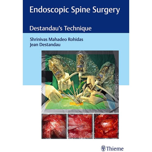 Endoscopic Spine Surgery 1st Edition