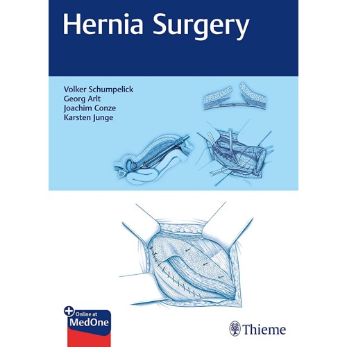 Hernia Surgery 1st Ed.