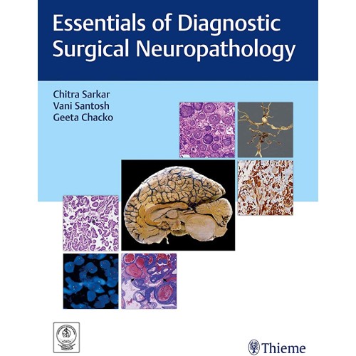 Essentials of Diagnostic Surgical Neuropathology 1st Edition