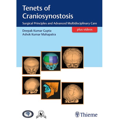 Tenets of Craniosynostosis