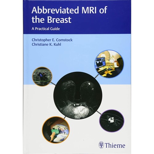 Abbreviated MRI of the Breast : A Practical Guide 1st Edition