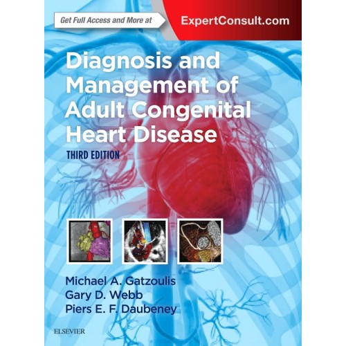 Diagnosis and Management of Adult Congenital Heart Disease - 3E