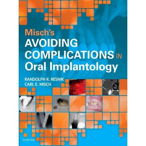 Avoiding Complications in Oral Implantology - 1E