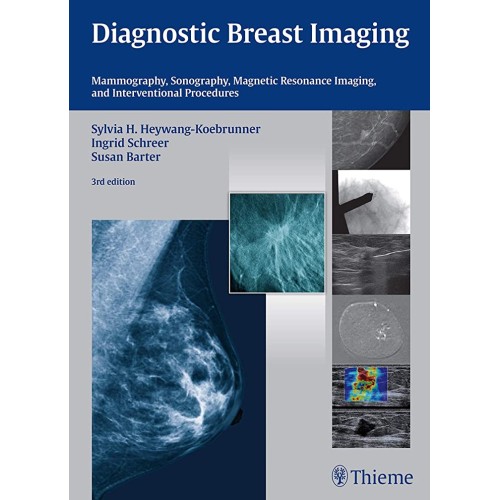 Diagnostic Breast Imaging Mammography Sonography M 3rd Ed