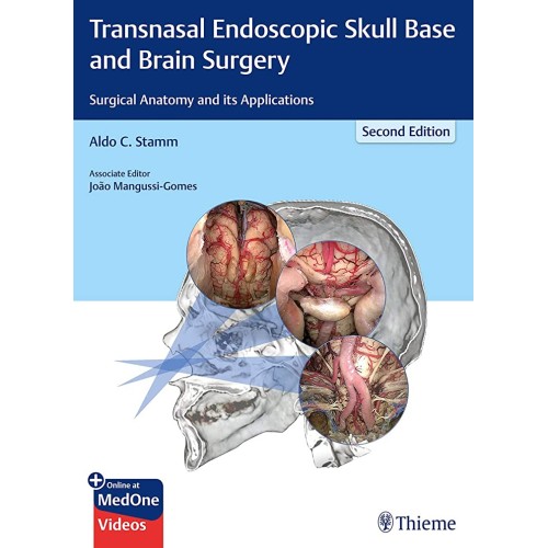 Transnasal Endoscopic Skull Base and Brain Surgery 2nd Ed.