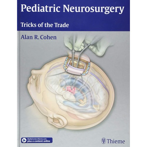 Pediatric Neurosurgery Tricks of the Trade