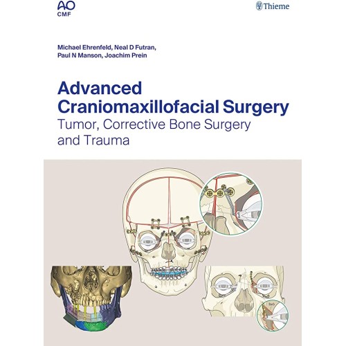 Advanced Craniomaxillofacial Surgery 1st Ed.