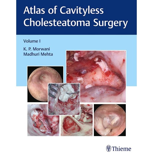 Atlas of Cavityless Cholesteatoma Surgery (Volume 1)