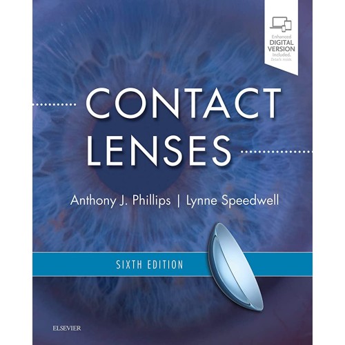 Contact Lenses - 6E