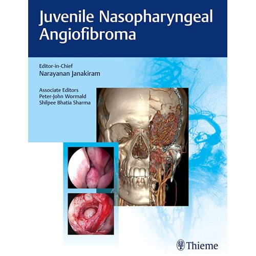 Juvenile Nasopharyngeal Angiofibroma 1st Edition