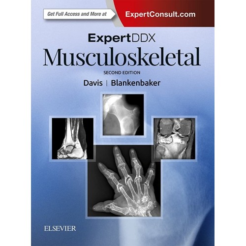 ExpertDDx: Musculoskeletal - 2E