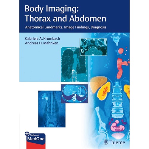 Body Imaging: Thorax and Abdomen 1st Edition