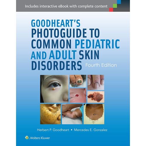 Goodheart's Photoguide To Common Skin Disorders