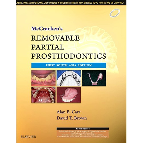 McCracken'S Removable Partial Prosthodontics - 1E