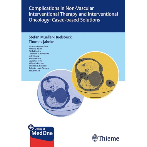 Complications in Non-vascular Interventional Therapy and Interventional Oncology: Case-based Solutions 1st Ed.