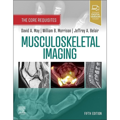 Musculoskeletal Imaging-5E