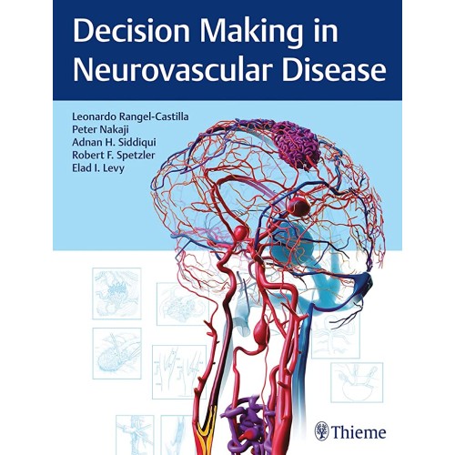 Decision Making in Neurovascular Disease 1st Edition