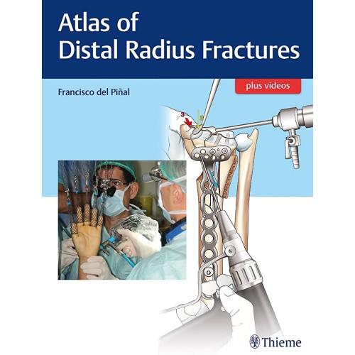 Atlas of Distal Radius Fractures 1st edition