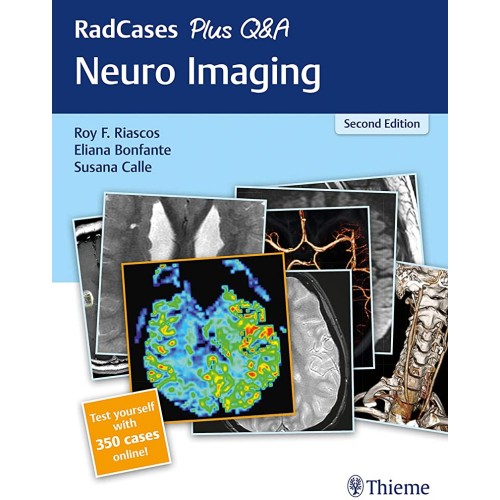 RadCases Plus Q&A Neuro Imaging 2nd Ed.