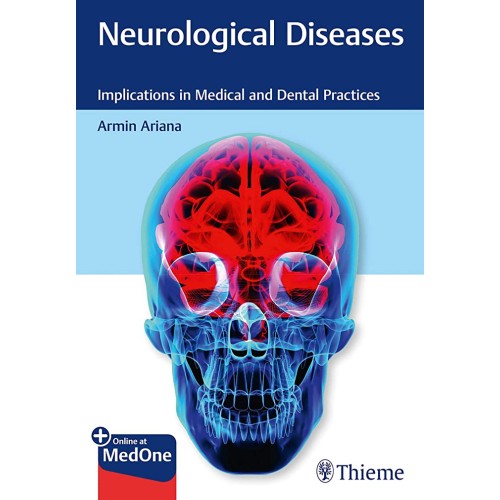 Neurological Diseases 1st Ed.