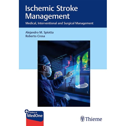 Ischemic Stroke Management 1st Ed.