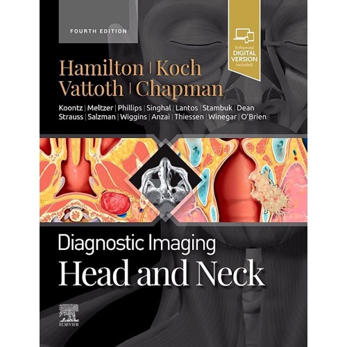 Diagnostic Imaging: Head and Neck-4E