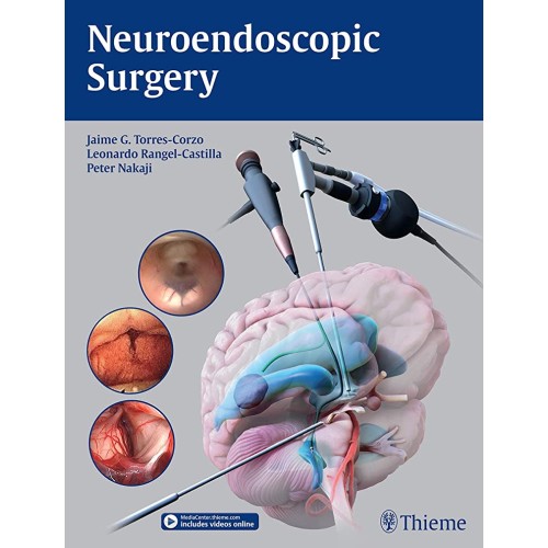 Neuroendoscopic Surgery 1st Edition