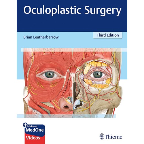 Oculoplastic Surgery 3rd Ed.