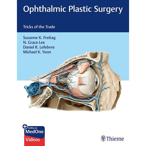 Ophthalmic Plastic Surgery 1st Ed.