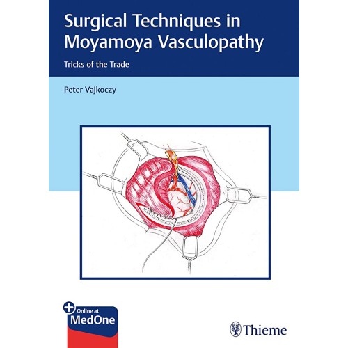 Surgical Techniques in Moyamoya Vasculopathy 1st Ed.