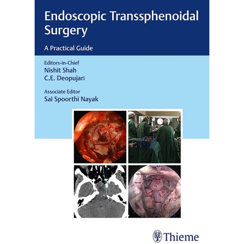 Endoscopic Transsphenoidal Surgery