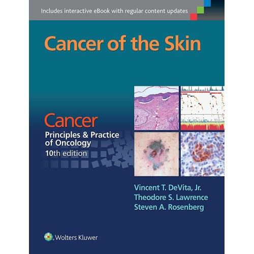 Cancer of the Skin: Cancer: Principles & Practice of Oncology - 10E