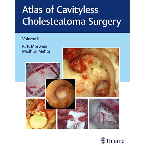 Atlas of Cavityless Cholesteatoma Surgery (Volume 2)