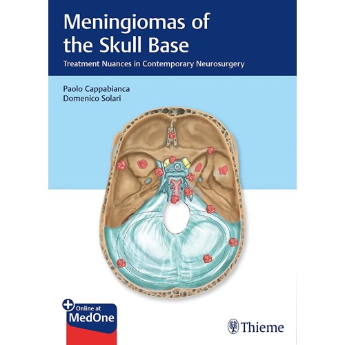 Meningiomas of the Skull Base 1st Edition