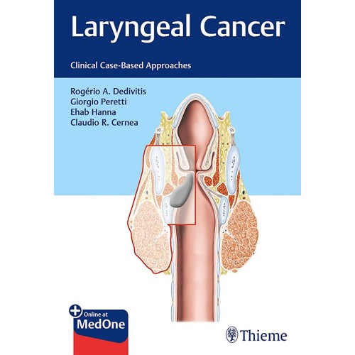 Laryngeal Cancer : Clinical Case-Based Approaches 1st Ed