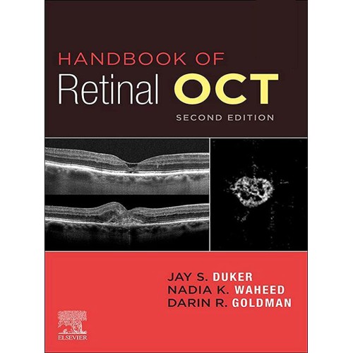 Handbook of Retinal OCT: Optical Coherence Tomography-2E