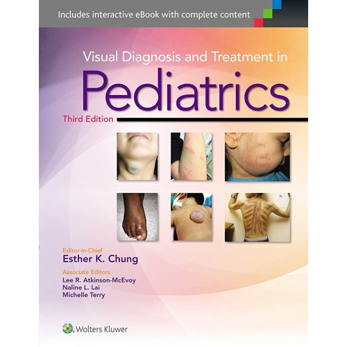 Visual Diagnosis and Treatment in Pediatrics ...