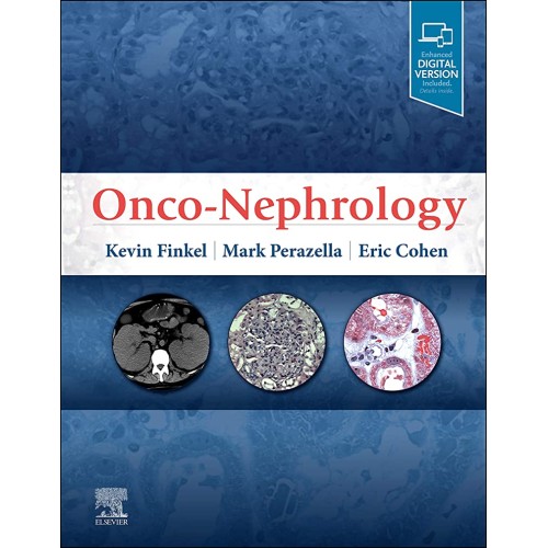 Onco-Nephrology - 1E