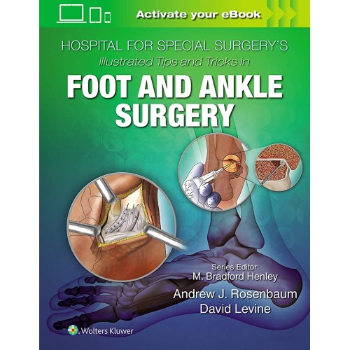 Hospital for Special Surgery's Illustrated Tips and Tricks in Foot and Ankle Surgery - 1E