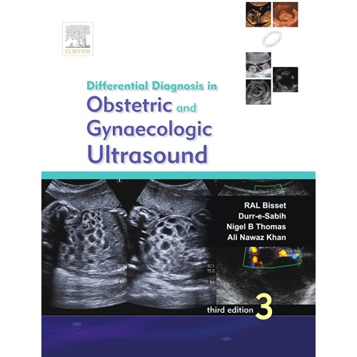 Differential Diagnosis in Obstetrics and Gynaecologic Ultrasound - 3E