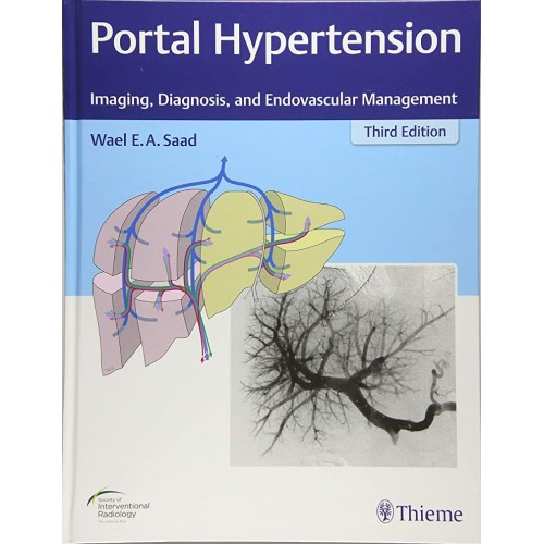 Portal Hypertension 3rd Edition