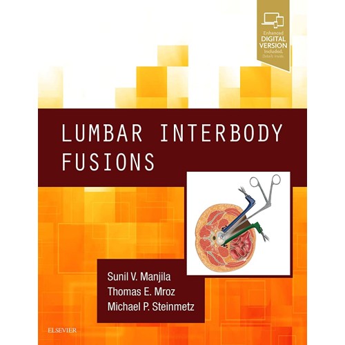 Lumbar Interbody Fusions -1E