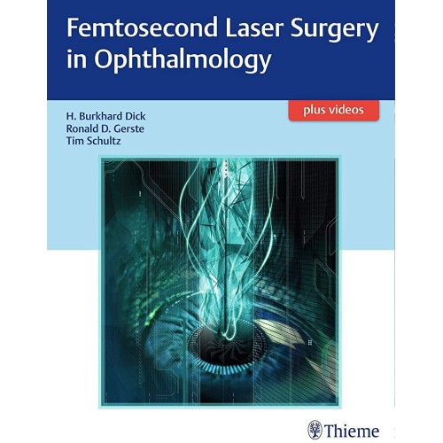 Femtosecond Laser Surgery in Ophthalmology 1st Ed.