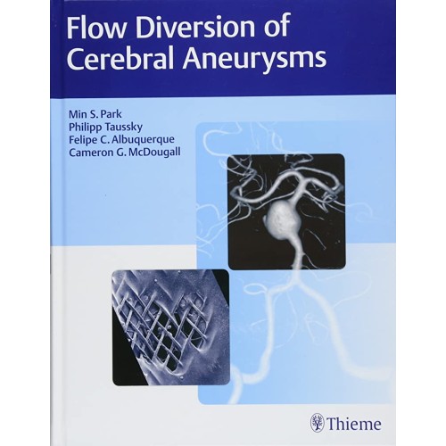 Flow Diversion of Cerebral Aneurysms 1st Edition