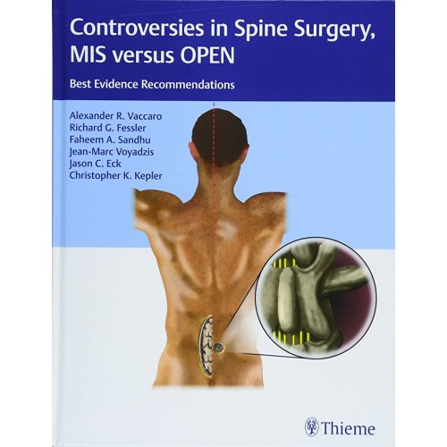 Controversies in Spine Surgery, MIS versus OPEN - 1E